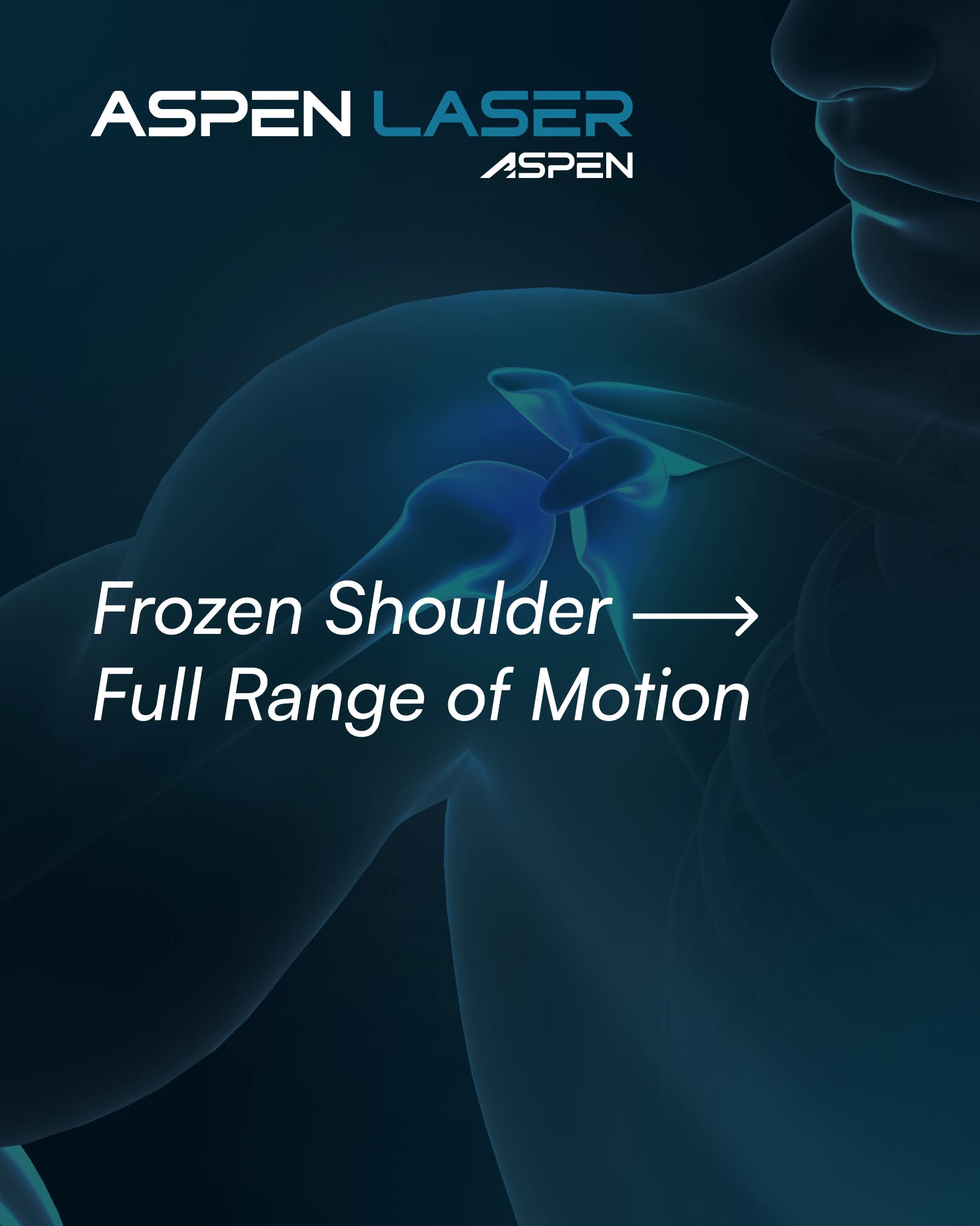 Frozen Shoulder to Full Range of Motion with Aspen Laser