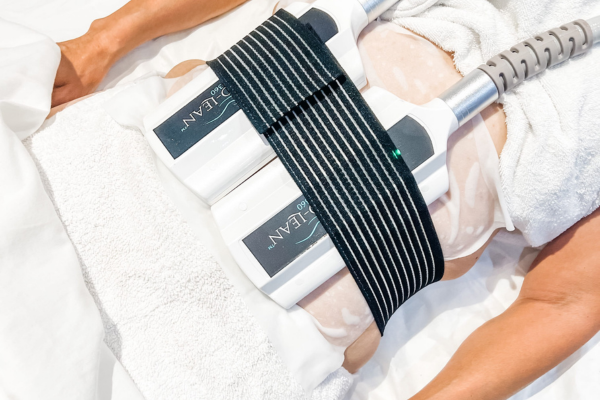 CryoSlimming