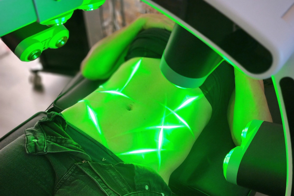 Laser-Lipo